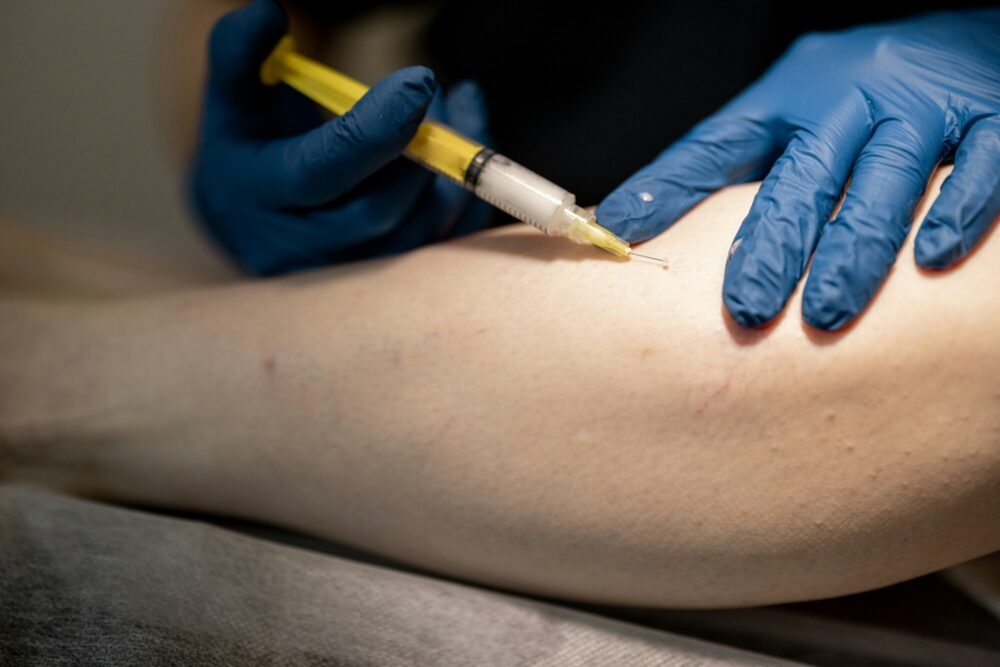 Phlebologist performs sclerotherapy on the veins of women's leg